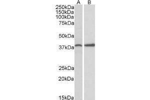 ABIN571043 (0. (PRKCDBP anticorps  (Internal Region))