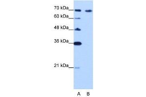 WB Suggested Anti-CARF  Antibody Titration: 0. (CDKN2AIP anticorps  (C-Term))