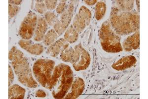 Immunoperoxidase of monoclonal antibody to XAB1 on formalin-fixed paraffin-embedded human stomach.