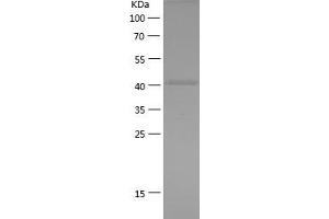 Western Blotting (WB) image for Histone Deacetylase 2 (HDAC2) (AA 386-488) protein (His-IF2DI Tag) (ABIN7123344)