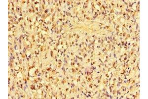 anti-Acidic (Leucine-Rich) Nuclear Phosphoprotein 32 Family, Member D (ANP32D) (AA 1-131) antibody