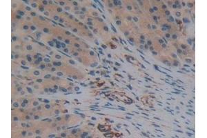 Detection of SNCG in Rat Stomach Tissue using Polyclonal Antibody to Gamma-synuclein (SNCG)