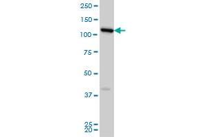 FLJ20097 monoclonal antibody (M01A), clone 2D11 Western Blot analysis of FLJ20097 expression in HeLa . (Syndetin/VPS50 anticorps  (AA 862-964))