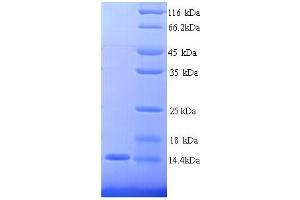 SDS-PAGE (SDS) image for Carcinoembryonic Antigen-Related Cell Adhesion Molecule 4 (CEACAM4) (AA 36-155), (partial) protein (His tag) (ABIN5713346)