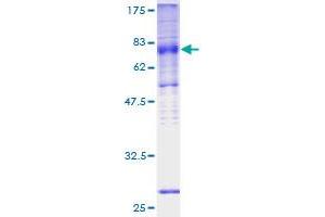 Solute Carrier Family 2 (Facilitated Glucose/fructose Transporter), Member 5 (SLC2A5) (AA 1-501) protein (GST tag)