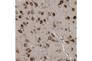 Immunohistochemical staining (Formalin-fixed paraffin-embedded sections) of human cerebral cortex with IL1RL2 polyclonal antibody  shows strong cytoplasmic positivity in neuronal cells at 1:50-1:200 dilution.