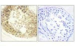 Immunohistochemistry analysis of paraffin-embedded human testis tissue, using ECRG4 antibody. (MEMO1 anticorps)