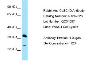 Western Blotting (WB) image for anti-C-Type Lectin Domain Family 4, Member D (CLEC4D) (C-Term) antibody (ABIN2789169)