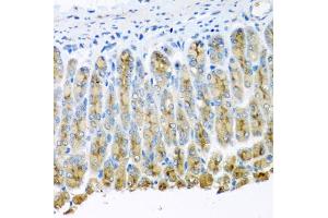 Immunohistochemistry of paraffin-embedded mouse stomach using UQCR10 antibody (ABIN5974450) at dilution of 1/100 (40x lens). (UQCR10 anticorps)