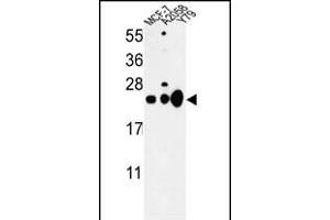 Western blot analysis of CBX1 Antibody (C-term) (ABIN652861 and ABIN2842560) in MCF-7, , Y79 cell line lysates (35 μg/lane). (CBX1 anticorps  (C-Term))