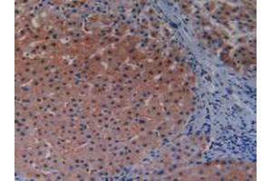 IHC-P analysis of Human Liver Tissue, with DAB staining. (MAP3K1 anticorps  (AA 1307-1509))