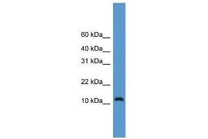 Western Blot showing CDC26 antibody used at a concentration of 1-2 ug/ml to detect its target protein. (CDC26 anticorps  (Middle Region))