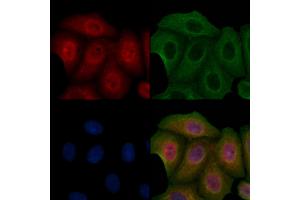 ABIN6257097 and ABIN6275838 staining Hela cells by IF/ICC.