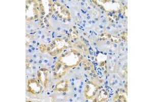 Immunohistochemistry of paraffin-embedded rat kidney using NDUFB10 antibody. (NDUFB10 anticorps  (AA 1-172))