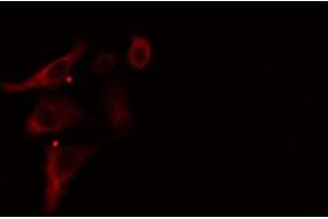 ABIN6274906 staining HuvEc cells by IF/ICC.