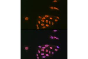 Immunofluorescence analysis of U-2 OS cells using K/MYST1/MOF Rabbit mAb (ABIN7268063) at dilution of 1:100 (40x lens). (MYST1 anticorps)