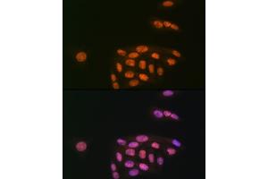 Immunofluorescence analysis of U-2 OS cells using K/MYST1/MOF Rabbit mAb (ABIN7268063) at dilution of 1:100 (40x lens). (MYST1 anticorps)