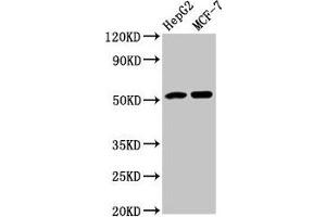 Western Blot Positive WB detected in: HepG2 whole cell lysate, MCF-7 whole cell lysate All lanes: AGT antibody at 3. (AGT anticorps  (AA 44-427))