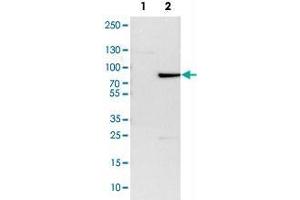 Western Blot analysis of Lane 1: NIH-3T3 cell lysate (mouse embryonic fibroblast cells) and Lane 2: NBT-II cell lysate (Wistar rat bladder tumor cells) with ZBTB7B polyclonal antibody . (ZBTB7B anticorps)