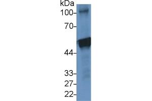 Detection of CK10 in Human A431 cell lysate using Polyclonal Antibody to Cytokeratin 10 (CK10)