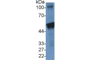 Detection of CK10 in Human A431 cell lysate using Polyclonal Antibody to Cytokeratin 10 (CK10) (Keratin 10 anticorps  (AA 153-456))