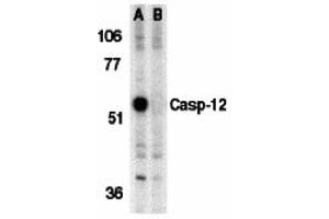 Western Blotting (WB) image for anti-Caspase 12 (Gene/pseudogene) (CASP12) (Middle Region) antibody (ABIN1030898) (Caspase 12 anticorps  (Middle Region))