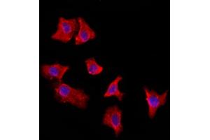 ABIN6264959 and ABIN6272887 staining HepG2 by IF/ICC. (EXOC2 anticorps  (N-Term))