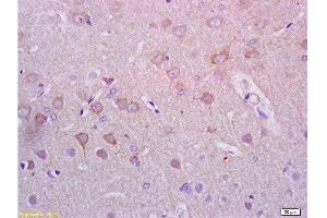 Formalin-fixed and paraffin embedded rat brain tissue with labeled Anti-Alpha-Synuclein/Syn/SNCA Polyclonal Antibody, Unconjugated  at 1:200, followed by conjugation to the secondary antibody and DAB staining (SNCA anticorps  (AA 1-140))