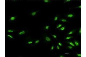 Immunofluorescence of monoclonal antibody to EHMT1 on HeLa cell.