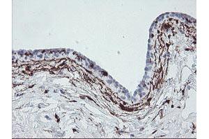 Image no. 4 for anti-Coagulation Factor XIII, A1 Polypeptide (F13A1) antibody (ABIN1498150)