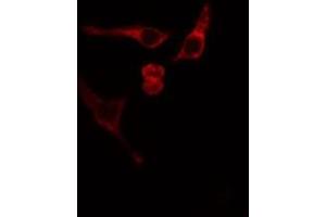 ABIN6275839 staining Hela cells by IF/ICC. (MATK anticorps  (Internal Region))