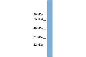 WB Suggested Anti-POLR3C Antibody Titration: 0. (POLR3C anticorps  (Middle Region))