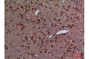 Immunohistochemistry (IHC) analysis of paraffin-embedded Rat Brain, antibody was diluted at 1:100.