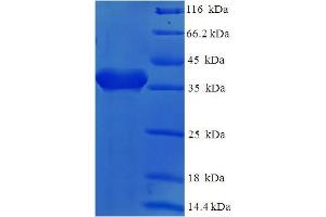 SDS-PAGE (SDS) image for CD2 (CD2) (AA 25-209) protein (His-SUMO Tag) (ABIN5709231)