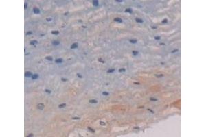 IHC-P analysis of Human Tissue, with DAB staining. (Cytokeratin 13 anticorps  (AA 104-403))