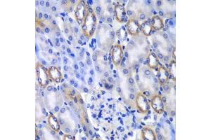 Immunohistochemistry of paraffin-embedded mouse kidney using MATK antibody  at dilution of 1:100 (40x lens). (MATK anticorps  (AA 352-466))