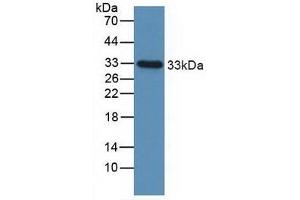Figure. (IGFBP2 anticorps  (AA 148-325))