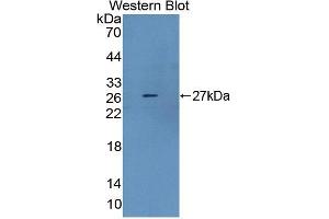 Western blot analysis of the recombinant protein. (Dystrophin anticorps  (AA 3059-3314))