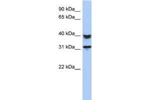 WB Suggested Anti-C5orf35 Antibody Titration: 0. (C5orf35 anticorps  (N-Term))