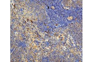 IHC analysis of IL31 using anti-IL31 antibody (ABIN6719334). (IL-31 anticorps  (AA 24-164))