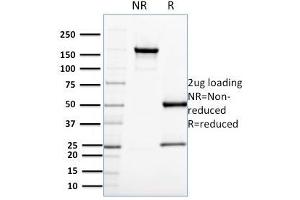 SDS-PAGE Analysis Purified CDC34 Mouse Monoclonal Antibody (CPTC-CDC34-2). (CDC34 anticorps)