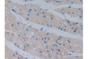 DAB staining on IHC-P; Samples: Mouse Heart Tissue (Cadherin 13 anticorps  (AA 478-690))