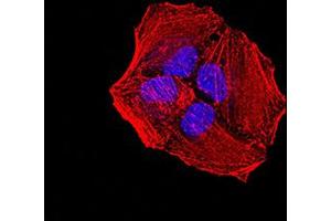 Immunofluorescence analysis of Hela cells using ACVR1 mouse mAb.
