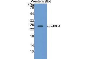 Western blot analysis of the recombinant protein. (Peroxiredoxin 5 anticorps  (AA 1-213))