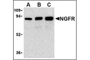 Western blot analysis of (A) 25 ng, (B) 50 ng, and (C) 100 ng of purified recombinant NGFR with this product at 1 μg/ml. (NGFR anticorps)