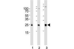 Western blot analysis of lysate from (1) human A431, (2) mouse NIH3T3, (3) rat C6 cell line using RAC1 antibody at 1:1000.