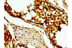 Immunohistochemistry of paraffin-embedded human testis tissue using ABIN7174250 at dilution of 1:100 (USP1 anticorps  (AA 453-592))