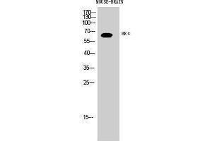Western Blotting (WB) image for anti-Estrogen Receptor 1 (ESR1) (Ser363) antibody (ABIN3175024) (Estrogen Receptor alpha anticorps  (Ser363))
