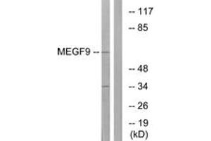 Western blot analysis of extracts from COLO cells, using MEGF9 Antibody. (MEGF9 anticorps  (AA 383-432))