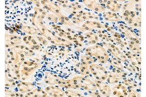 ABIN6262571 and ABIN6277224 at 1/100 staining Rat kidney tissue by IHC-P.